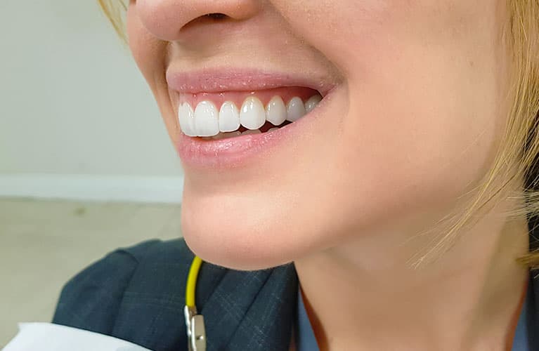 Busca melhorar o sorriso? A resposta está num Dentista especialista em Estética!