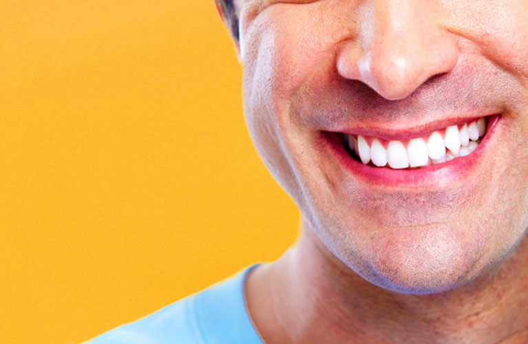 Faceta Dental é aposta para sorrisos brancos e bonitos por muito tempo!