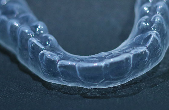 aparelho invisivel para os dentes